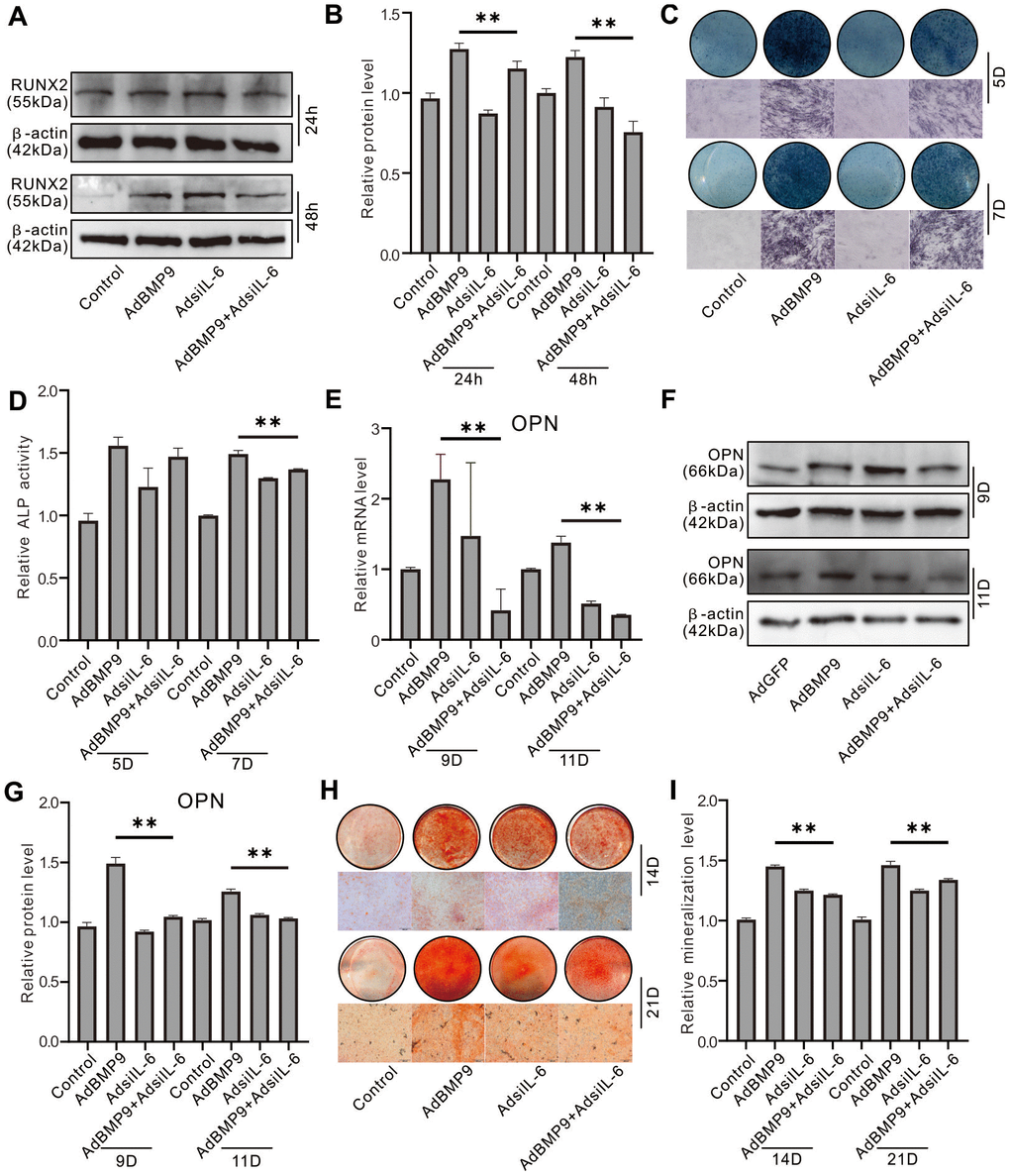 Effect of IL-6 knockdown on the osteoblastic markers induced by BMP9 in MEFs. (A) Effect of BMP9 and/or IL-6 knockdown on RUNX2 protein level were measured using western blot assay. (B) Western blot assay quantification shows the effect of BMP9 and/or IL-6 knockdown on RUNX2 protein level. (C) Effect of BMP9 and/or IL-6 knockdown on ALP activity was measure using histochemical stain. (D) Quantification of histochemical stain shows the effect of BMP9 and/or IL-6 knockdown on ALP activity. (E) Effect of BMP9 and/or IL-6 knockdown on OPN mRNA expression was measured using real-time PCR assay. (F) Western blot assay shows the effect of BMP9 and/or IL-6 knockdown on OPN protein level. (G) Quantification results of western blot assay show the effect of BMP9 and/or IL-6 knockdown on OPN protein level. (H) Effect of BMP9 and/or IL-6 knockdown on mineralization was measured using Alizarin Red S stain. (I) Quantification of Alizarin Red S stain show the effect of BMP9 and/or IL-6 knockdown on mineralization. (**P 