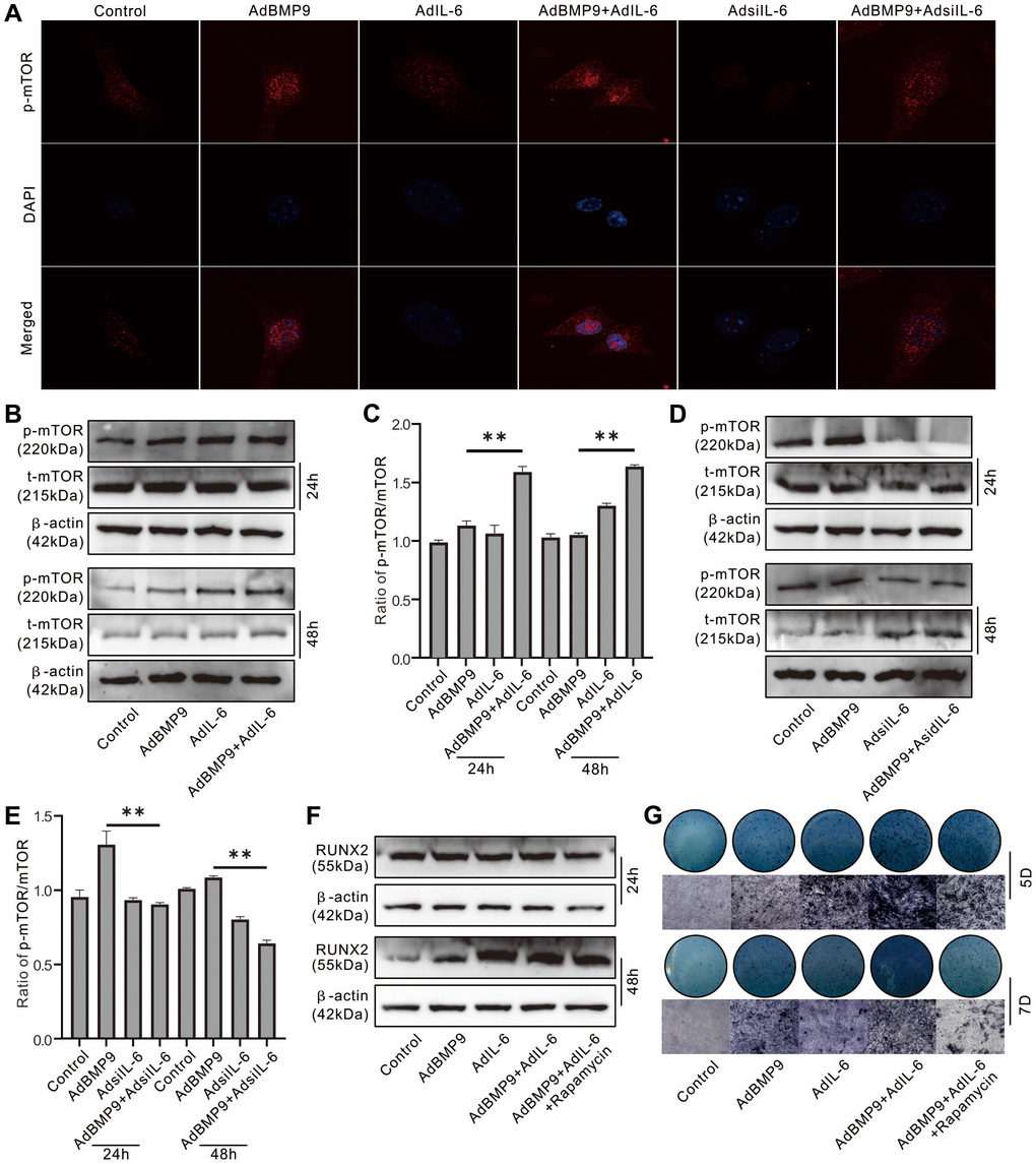 Role of mTOR in the effect of IL-6 on promoting osteogenic differentiation in MEFs. (A) Effect of BMP9, IL-6, and/or IL-6 knockdown on mTOR phosphorylation (p-mTOR) was measured using immunofluorescent stain and confocal assay. (B) Effect of BMP9 and/or IL-6 on total mTOR and p-mTOR level was measured using western blot assay. (C) Quantification of western blot assay show the effect of BMP9 and/or IL-6 on total mTOR and p-mTOR. (D) Effect of BMP9 and/or IL-6 knockdown on total mTOR and p-mTOR level was measured using western blot assay. (E) Quantification of western blot assay show the effect of BMP9 and/or IL-6 knockdown on total mTOR and p-mTOR. (F) Effect of IL-6 and/or rapamycin on BMP9-induced RUNX2 protein level was measured using western blot assay. (G) Effect of IL-6 and/or rapamycin on BMP9-induced ALP activity was measured using histochemical stain. (Rapamycin: mTOR inhibitor). (**P 