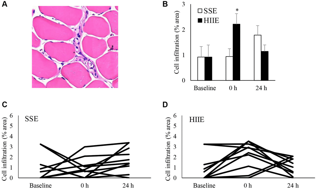 Cell infiltration in human skeletal muscle after SSE and HIIE. A representative graph of cell infiltration increased immediately following HIIE (A). This response is delayed after SSE with similar amount of cycling work (B). Individual response after SSE (C) and HIIE (D) are shown in the lower panel. *Significant difference against pre-exercise baseline, p 