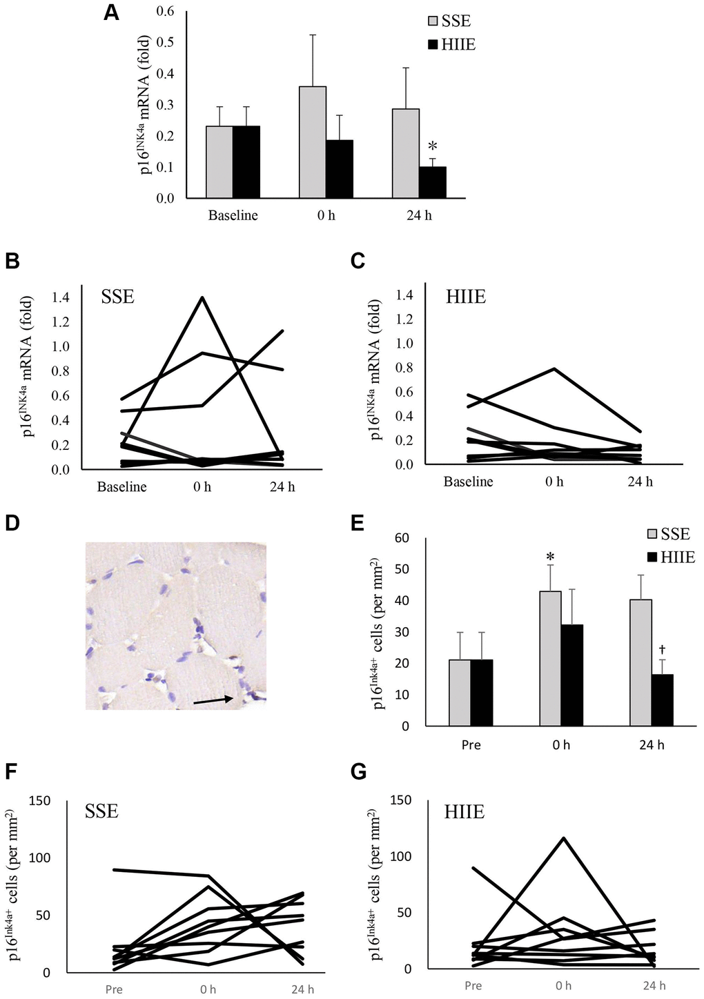 p16INK4a mRNA in human skeletal muscle 24 h after SSE and HIIE. The cellular senescence marker p16INK4a mRNA decreased 24 h after HIIE (d = 0.90, p = 0.04), whilst no change was observed after SSE at similar amount of cycling work (A). Individual responses in p16INK4a mRNA to SSE and HIIE are shown in (B and C), respectively. p16INK4a-expressing cells (representing all replicable cells) were located outsides myofibers, indicated by an arrow to brown precipitates (D). p16INK4a-expression cells (replicable cells) increased immediately after HIIE and returned to baseline in 24 h (E). Individual responses to SSE and HIIE are shown in (F and G), respectively. *Significant difference against pre-exercise baseline, p †Significance against SSE, p 