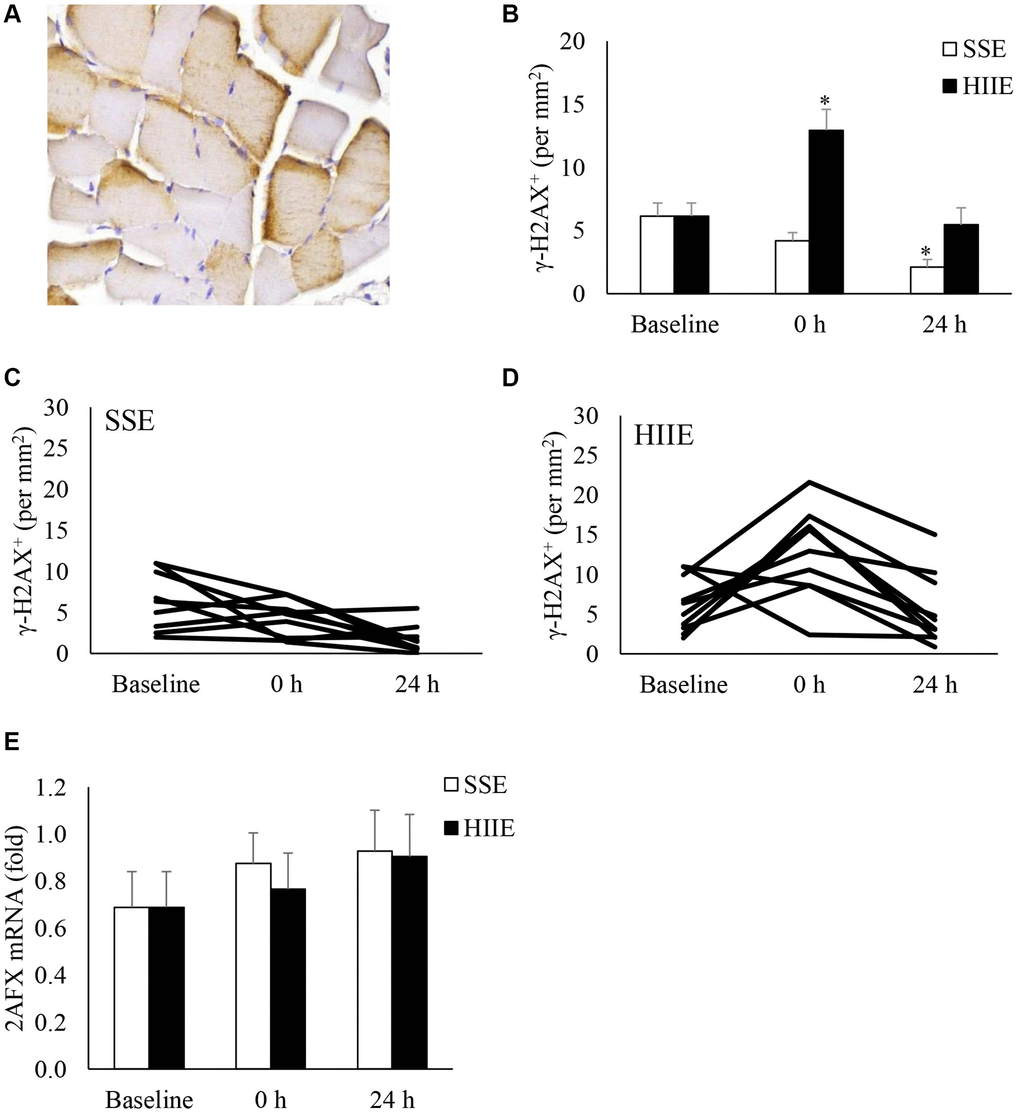 γ-H2AX+ myofibers in human skeletal muscle after SSE and HIIE. A representative muscle cross-section of immunohistochemical stain indicates brown γ-H2AX signals concentrated near periphery of myofibers (A). γ-H2AX+ myofibers elevated immediately only after HIIE (not SSE) and returned to baseline in 24 h (B). Individual responses to SSE and HIIE are shown in (C and D), respectively. H2AX mRNA was not influenced by exercise (E). *Significant difference against pre-exercise baseline, p †Significance against SSE, p 