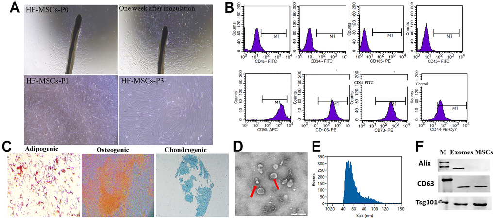 Classification of hair follicle mesenchymal stem cells (HF-MSCs) and HFMSC-derived exosomes (HF-MSC-Exo). (A) Morphological observation of MSCs (200×). (B) MSCs surface marker molecules identified by flow cytometry. HF-MSCs were positive for CD90, CD105, CD73, CD44 and negative for CD34, CD45 and CD31. (C) Cell lineage-induced chondrogenic, osteogenic, and adipogenic differentiation were evaluated by toluidine blue staining, alizarin red staining, and Oil-Red-O staining. Scale bar=100 μm. (D) Micrographs of transmission electron microscopy of purified HF-MSC-Exo, showing a spheroid shape. Scale bar=50 nm. (E) The size distribution of the HF-MSC-s was assessed utilizing dynamic light scattering. (F) Western blotting results indicated the positive expression of Alix, CD63, and Tsg101 protein in HF-MSC-Exo.