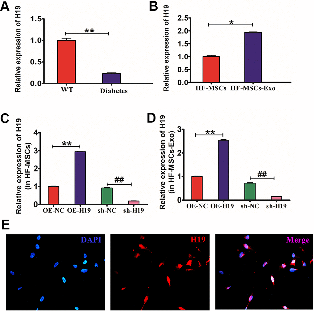 Production HF-MSCs and HF-MSC-Exo with lncRNA H19. (A) qRT-PCR was utilized to identify the lncRNA H19 expression in mouse diabetic skin. *PB) qRT-PCR was utilized to identify the lncRNA H19 expression in HF-MSCs and HF-MSC-Exo. *PC, D) qRT-PCR was employed to ascertain the efficiency of overexpressing or silencing lncRNA H19 in HF-MSCs and HF-MSC-Exo.**P##PE) Subcellular localization of lncRNA H19 in HFMSCs detected by FISH (400×). Data measured are articulated as mean ± SD.