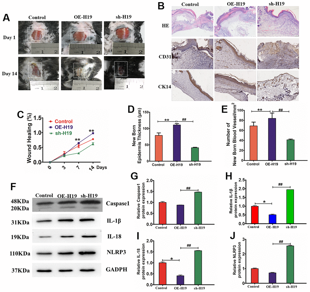 HF-MSC-Exo carrying lncRNA H19 promote mouse skin wound healing. (A) Representative images displaying mouse skin wound healing. (B) Wound histology after H&E staining. Tissue sections acquired from the wound site on day 14 after different injections were stained with antibodies against cytokeratin 14 and CD31. Scale bar = 200 μm. (C) Statistic the wound healing percent. (D) Quantitative analysis of the thickness of the new epidermis. (E) Quantitative analysis of the number of blood vessels. n = 3 per cohort. **PF) Protein bond diagram of caspase-1 (I), IL-1β (J), IL-18 (K), and NLRP3 ascertained by western blot analysis. (G–J) Relative protein expression of caspase-1, IL-1β, IL-18, and NLRP3 normalized to GAPDH was evaluated by western blot analysis.