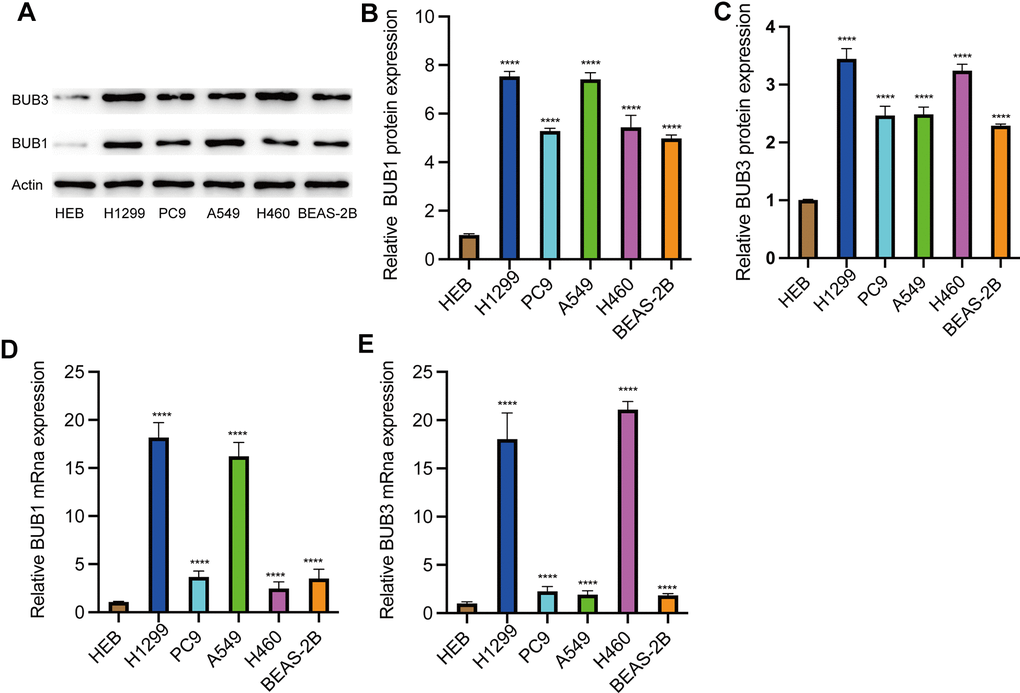 Expression of BUB1/3 in LUAD cell lines. (A–C) The protein expression levels of BUB1/3 in the normal HBE cell line, human LUAD cell line. ****, p D, E) The mRNA expression levels of BUB1/3 in the normal HBE cell line, human LUAD cell line. ****, p 