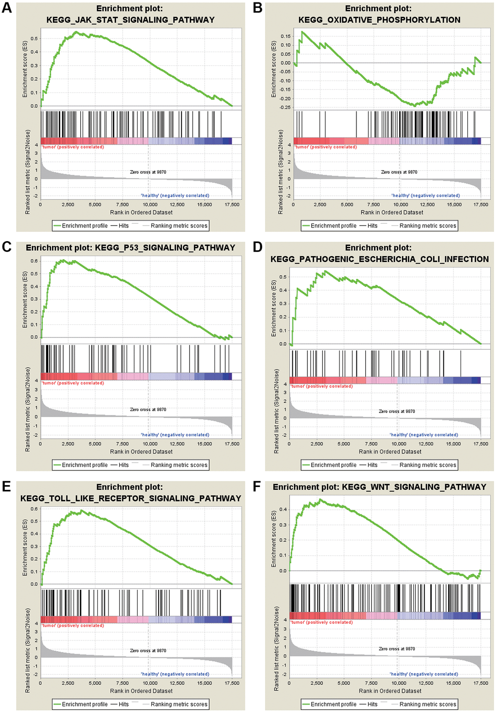 KEGG enrichment analysis for the DEGs by GSEA. (A) JAK-STAT signaling pathway. (B) Oxidative phosphorylation. (C) P53 signaling pathway. (D) Pathogenic Escherichia coli infection. (E) TOLL like receptor signaling pathway. (F) WNT signaling pathway.