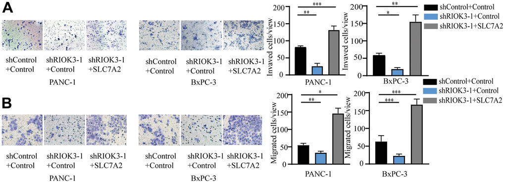 RIOK3 promotes invasion and migration of PDAC cells via SLC7A2. (A, B) The invasion (A) and migration (B) abilities of the above cell lines in E were determined using the migration and invasion assays, respectively. One-way ANOVA test. All experiments were performed independently at least three times. The star (*) symbol denotes the level of statistical significance: * p 