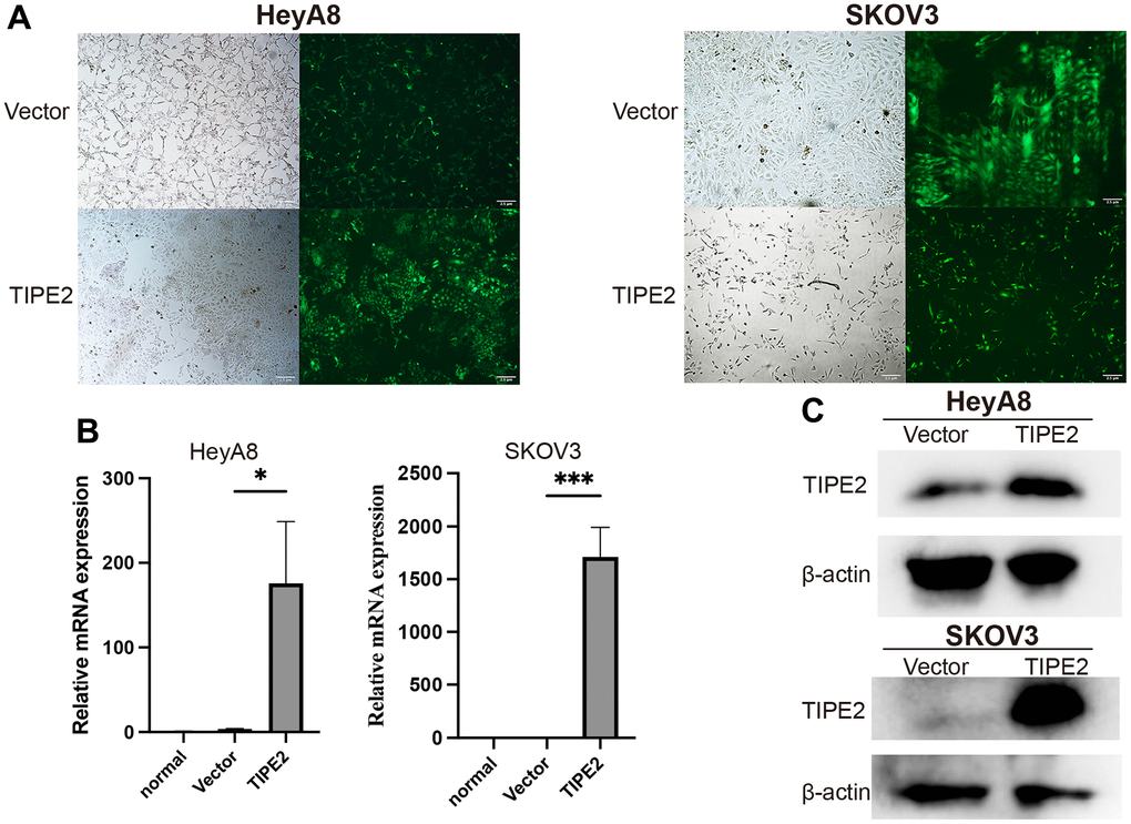 Overexpression of TIPE2 in EOC cells by lentivirus transfection. (A) Stable transfected EOC cell lines were established by lentivirus transfection. Representative images of stably transfected cells in bright field and dark fields are shown. Fluorescence microscopy showed that transfection efficiency was approximately 80%, and the cell state was normal. (B) qRT-PCR was conducted to compare endogenous TIPE2 expression between EOC cells transduced with lentivirus (n=3). TIPE2 expression was normalized to β-actin control. (C) TIPE2 protein expression in HeyA8 and SKOV3 cells by western blot analysis. β-actin was used as an internal control. Data are presented as mean ± SD. Statistical significance is indicated as: *p p 