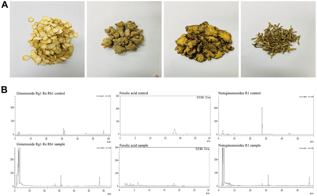 Main compounds of the YHY decoction. (A) Four traditional Chinese medicines of YHY decoction. (B) HPLC of ferulic acid, notoginsenoside R1, ginsenoside Rg1, ginsenoside Re, and ginsenoside Rb1 in YHY decoction.