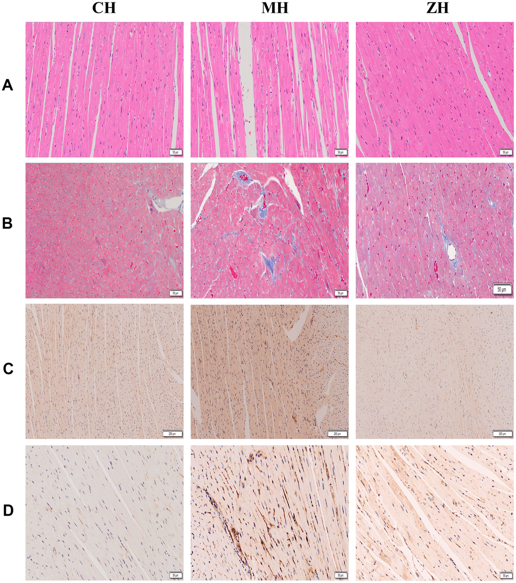 Histopathological detection of mouse myocardium (n=3). (A) HE staining; (B) Masson staining; (C) AGE protein immunohistochemical staining; (D) p53 protein immunohistochemical staining.