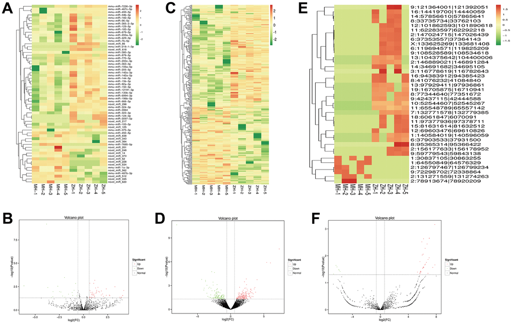 Profiles of differentially expressed of miRNAs, lncRNAs and circRNAs between the model group and YHY decoction group. Heatmap expression of DEG miRNAs (A), the volcano plot of DEG miRNAs (B), DEG lncRNAs (C), DEG lncRNAs (D), DEG circRNAs (E) and DEG circRNAs (F).