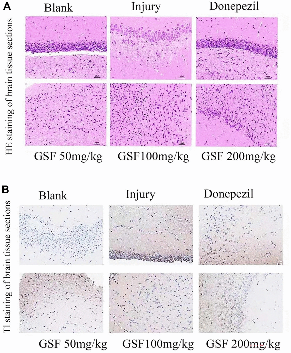 Staining of mouse hippocampal sections (A) HE staining of mouse hippocampal sections. (B) TUNEL staining of mouse hippocampal sections.