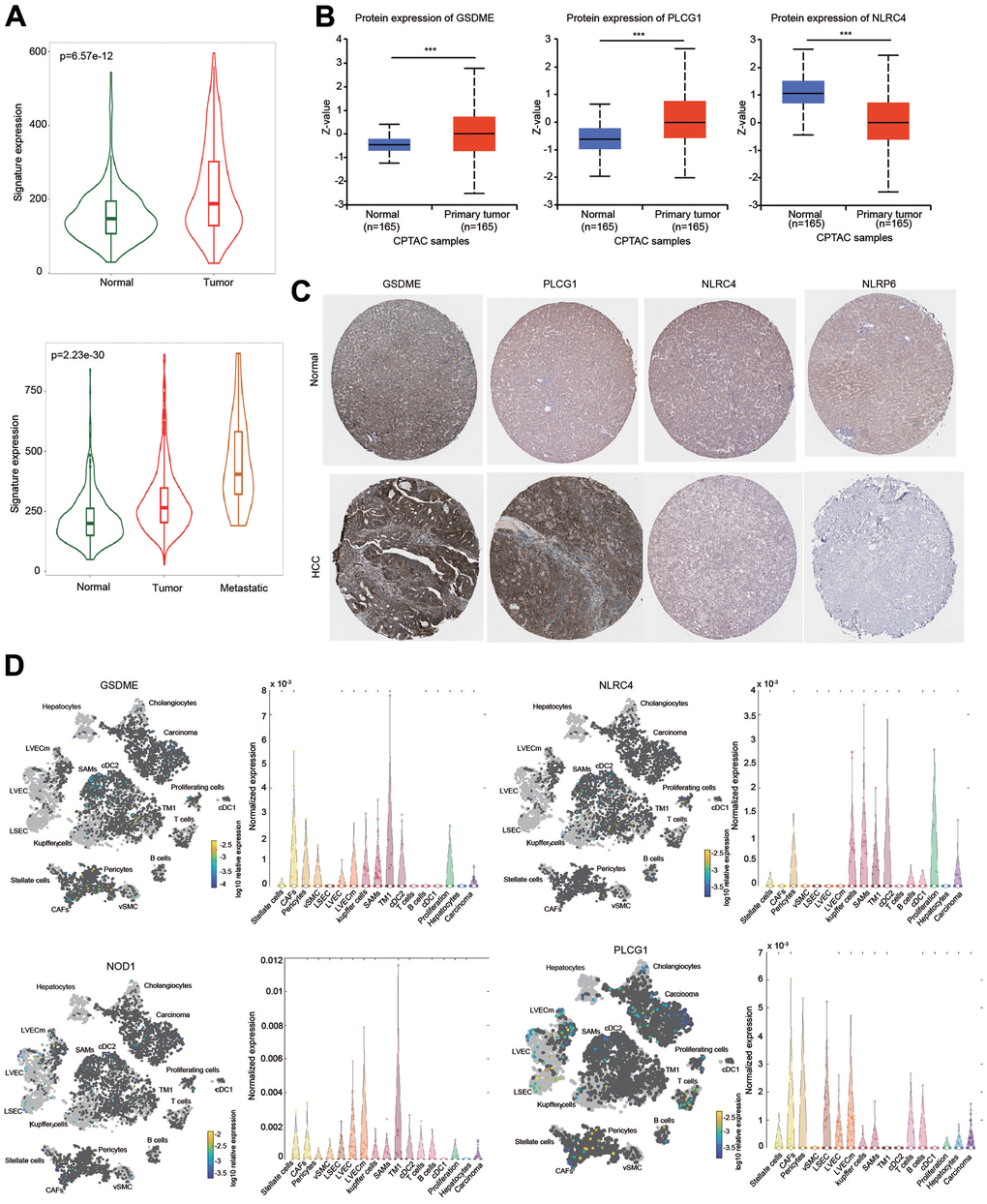 Expression of the prognostic signature and PRGs in HCC samples and normal liver samples. (A) The expression of the prognostic signature in HCC was examined using the TMNplot database. (B) The protein levels of GSDME, NLRC4 and PLCG1 were examined using the CPTAC database. (C) IHC analysis of the protein levels of GSDME, PLCG1, NLRC4 and NLRP6 using the HPA database. (D) Differential expression and distribution of GSDME, PLCG1, NLRC4 and NOD1 in HCC based on single-cell RNA-sequence analysis using the Human Liver Browser database. ***p 