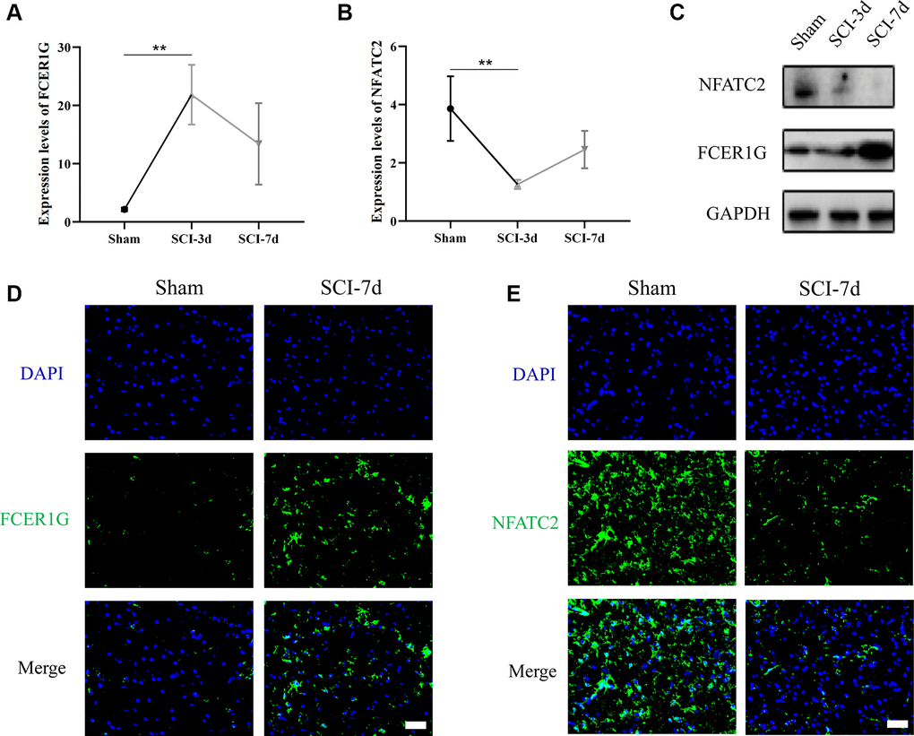 Verification of the expression of Core IRGs via rat SCI model. (A, B) Sequencing results of Core IRGs in SCI and sham group; (C) WB analysis demonstrating the expression of Core IRGs in the sham, SCI-3d and 7d group, respectively; (D, E) Immunofluorescence showed the expression of Core IRGs in sham and SCI-7d groups. Bar = 50 um; *p **p ***p 