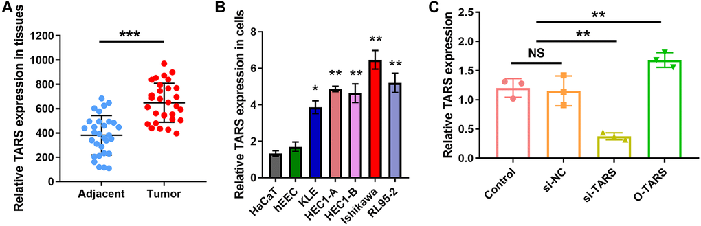 High TARS expression in tissue and cell. (A) TARS expression in 30 endometrial cancer tissues and adjacent normal tissues by qRT-PCR. (B) Relative TARS expression in HaCaT, hEEC, KLE, HEC1-A, HEC1-B, Ishikawa, and RL95-2 by qRT-PCR. (C) Relative TARS expression in Ishikawa cells transfected with control, si-NC, si-TARS, and O-TARS by qRT-PCR. Abbreviation: NS; no significance; **P ***P 