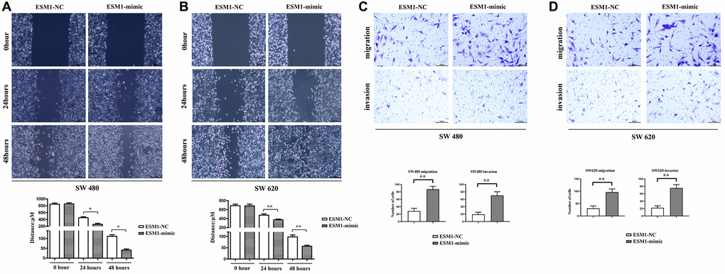 Detection of migration and invasion abilities in SW480 and SW620 cells. (A) Distances of migration at 0, 24 and 48 h after scratch formation in SW480 cells. (B) Distances of migration at 0, 24 and 48 h after scratch formation in SW620 cells. (C) Number of migrating and invading SW480 cells. (D) Number of migrating and invading SW620 cells. *p **p 