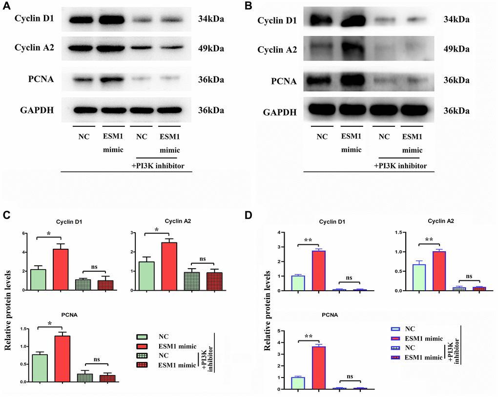 Relative protein expressions of Cyclin D1 and Cyclin A2 in SW480 and SW620 cells. (A, B) Relative protein expressions of Cyclin D1 and Cyclin A2 in ESM1-NC group, ESM1-mimic group, ESM1-NC + PI3K inhibitor group and ESM1-mimic + PI3K inhibitor group. (C, D) Statistics for Cyclin D1 and Cyclin A2 protein expressions. *p **p 