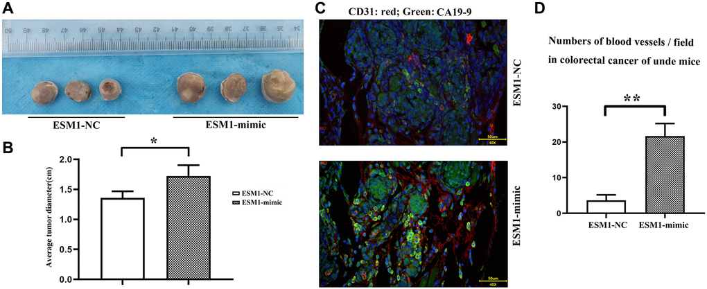 ESM1 promotes the occurrence and development of tumors in nude mice. (A) SW480 cells transfected with ESM1-NC and ESM1-mimic are subcutaneously injected into nude mice to generate tumors. (B) Statistics for tumor volume in nude mice. (C) Immunofluorescence double stain result plot.green:CA199, red:CD31; (D) Compared with the ESM1-NC group, CA199 and CD31 were significantly higher in the ESM1-mimic group. *p **p 