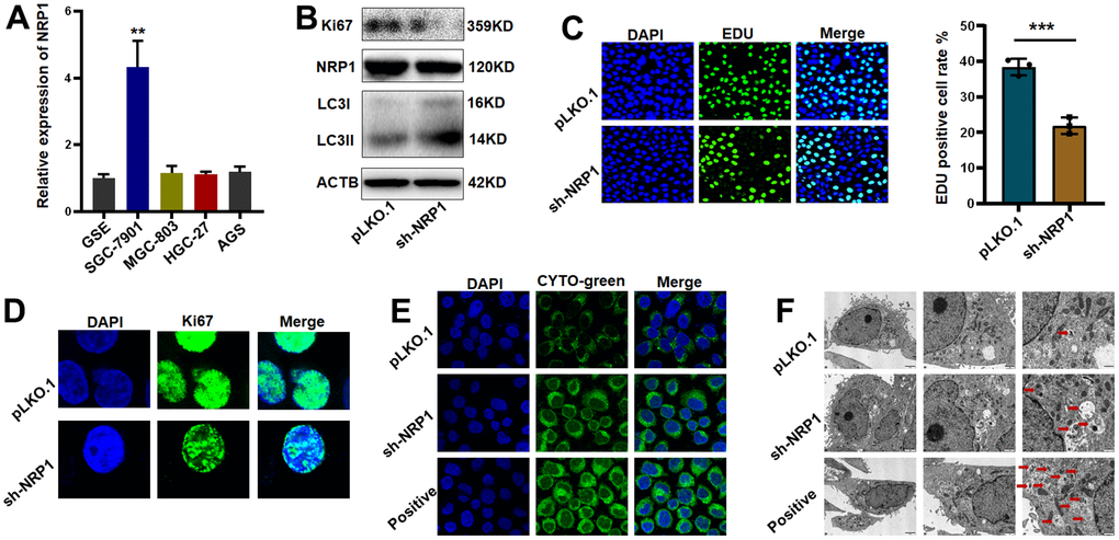 Validation of NRP1’s regulation of tumor autophagy and proliferative capacity in vitro. (A) QPCR was used to detect NRP1 gene expression in gastric cancer cell lines. (B) western blot analysis. (C, D) EdU assay and cell immunofluorescence were used to detect the effect of NRP1 knockout on cell proliferation. (E) Autophagy assay to detect the effect of NRP1 knockdown on autophagy. (F) The effect of NRP1 knockdown on autophagy was detected by transmission electron microscopy. (*PPPP