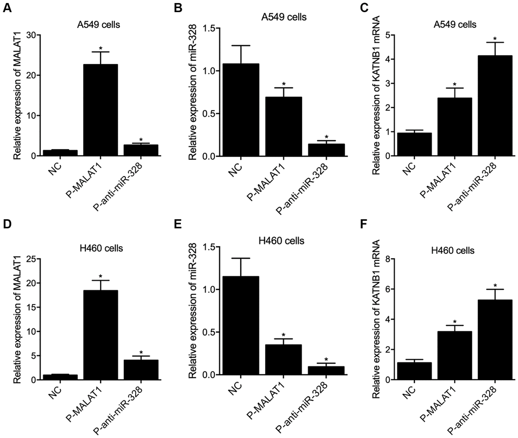 Overexpression of MALAT1 and suppression of miR-328 enhanced the expression of KATNB1 in A549 and H460 cells (*p value  (A) The expression of MALAT1 was enhanced by P-MALAT1 and P-anti-miR-328 in A549 cells. (B) The expression of miR-328 was suppressed by P-MALAT1 and P-anti-miR-328 in A549 cells. (C) The expression of KATNB1 mRNA was enhanced by P-MALAT1 and P-anti-miR-328 in A549 cells. (D) The expression of MALAT1 was enhanced by P-MALAT1 and P-anti-miR-328 in H460 cells. (E) The expression of miR-328 was suppressed by P-MALAT1 and P-anti-miR-328 in H460 cells. (F) The expression of KATNB1 mRNA was enhanced by P-MALAT1 and P-anti-miR-328 in H460 cells.