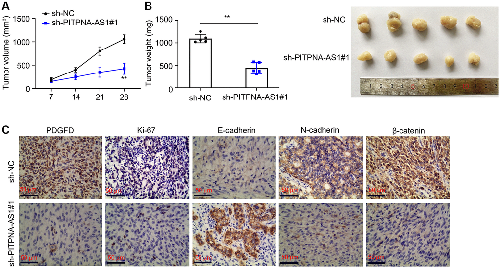 Knockdown of PITPNA-AS1 inhibits HCC progression. (A and B) Tumor volume and weight in xenograft nude models. (C) Expression levels of PDGFD, β-catenin, Ki67, E-cadherin, and N-cadherin were determined by IHC. **P 