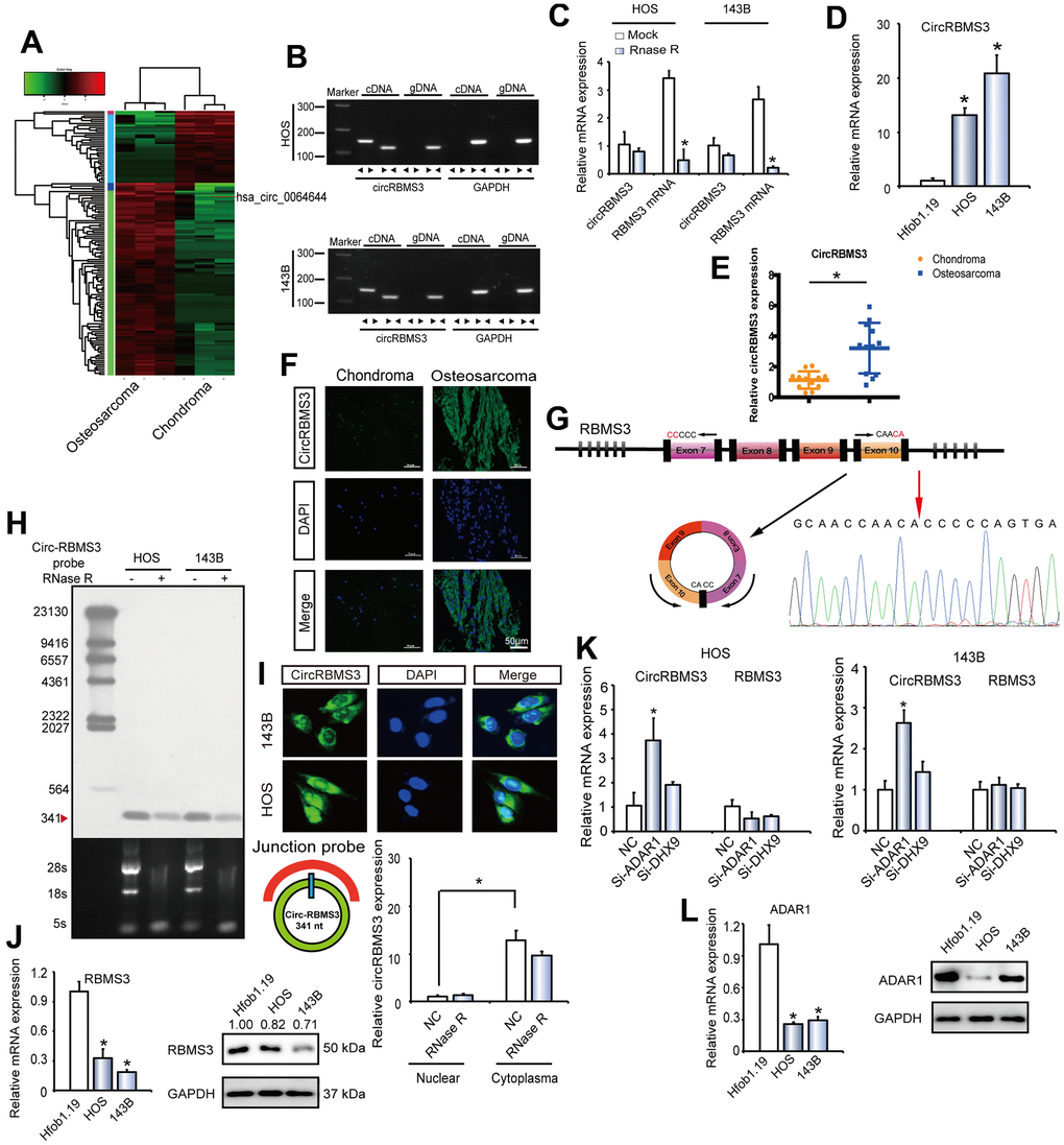 circRBMS3 validation and expression in OS tissue and cells. (A) Heat map of all differentially expressed circRNAs between chondroma and OS tumor tissues. (B) The presence of circRBMS3 was validated in HOS and 143B OS cell lines by RT–qPCR. Divergent primers amplified circRBMS3 in cDNA, but not in genomic DNA. GAPDH was used as a negative control. (C) The expression of circRBMS3 and RBMS3 mRNA in HOS and 143B cells treated with or without RNase R was detected by qPCR. The relative levels of circRBMS3 and RBMS3 mRNA were normalized to the value measured in the mock treatment. Data represent the mean ± SD (n = 3). * P D) CircRBMS3 expression in hFOB1.19 and OS (OS) cell lines (HOS and 143B) was evaluated by RT-qPCR. Data represent the mean ± standard deviation (SD) (n = 3). * P E) CircRBMS3 expression was higher in human OS than in chondroma tissue. Data represent the mean ± SD (n = 12). * P F) CircRBMS3 expression was higher in human OS than in chondroma tissue. Representative images are shown (400 × magnification). (G) Schematic illustration showing RBMS3 exon 7–10 circularization forming circRBMS3 (black arrow). The presence of circRBMS3 was validated by RT–qPCR, followed by Sanger sequencing. Red arrow represents “head-to-tail” circRBMS3 splicing sites. (H) Northern blots for detecting circRBMS3 in HOS and 143B cells treated with or without RNase R digestion. The upper panels show the probed blots of circRBMS3, and the red triangle represents the circRBMS3 band size (341 bp). The lower panels show the gel electrophoretic results of RNA with or without RNase R digestion. (I) RNA fluorescence in situ hybridization (FISH) showed that circRBMS3 was predominantly localized in the cytoplasm. CircRBMS3 probes were labeled with Alexa Fluor 488. Nuclei were stained with DAPI. Scale bar, 50 μm. Upper panel: FISH with junction-specific probes indicates the cellular localization of circRBMS3. Scale bars = 5 μM. Lower panel: circRBMS3 was detected in different cell fractions. Nuclear and cytoplasmic RNA was extracted, and junction primers were used for circRBMS3 detection. U6 was used as an internal control of nuclear RNA, and GAPDH was used as internal control for cytoplasmic RNA. Values are the average ± SD of 3 independent experiments. (J) RBMS3 expression in hFOB1.19 and OS (OS) cell lines (HOS and 143B) was evaluated by WB and RT-qPCR. Data represent the mean ± standard deviation (SD) (n = 3). * P K) RT-qPCR for RBMS3 mRNA and circRBMS3 upon DHX9 and ADAR1 depletion using RNAi in OS cell lines. (L) ADAR1 expression in hFOB1.19 and OS cell lines (HOS and 143B) was evaluated by RT-qPCR and WB. Data represent the mean ± standard deviation (SD) (n = 3). * P 