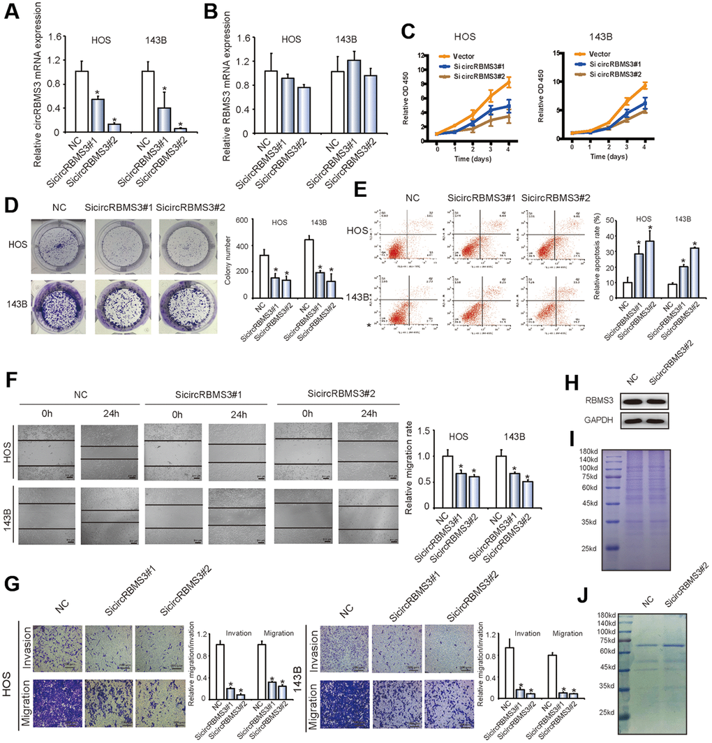 Knockdown of circRBMS3 inhibits the migration and invasion of OS cell lines in vitro. (A, B) The expression levels of circRBMS3 and RBMS3 mRNA in HOS and 143B cells after stable transfection of circRBMS3 short hairpin RNAs or vector plasmids were detected by qPCR. Data represent the mean ± SD (n = 3). *P C) SiRNA-mediated circRBMS3 knockdown suppressed OS cell proliferation, as determined by CCK-8 assays. Data represent the mean ± SD (n = 6). (D) CircRBMS3 knockdown suppresses cell growth, as determined by colony formation assays (details are shown in the insets). Error bars represent the mean ± SD of three independent experiments. * P E) HOS and 143B cells were transfected with sicircRBMS3, followed by Annexin V-FITC/PI staining. The percentage of apoptotic cells is shown as the mean ± SD from three independent experiments. * P F) The effect of sicircRBMS3 on cell migration capability was evaluated by wound healing assays using HOS and 143B cells. Data are the mean ± SD, n = 3. *P G) CircRBMS3 knockdown suppresses cell migration and invasion abilities of HOS and 143B cells, as evaluated by transwell migration and Matrigel™ invasion assays. Data represent the mean ± SD (n = 3). * P H) CircRBMS3 knockdown did not affect linear RBMS3 expression. (I) Total cell lysates were separated by SDS-PAGE and Coomassie blue staining. (J) Cell lysates were precipitated with anti-RBMS3 antibody followed by SDS-PAGE and Coomassie blue staining. Transfection with circRBMS3 siRNA did not affect the interaction of RBMS3 with its partners.