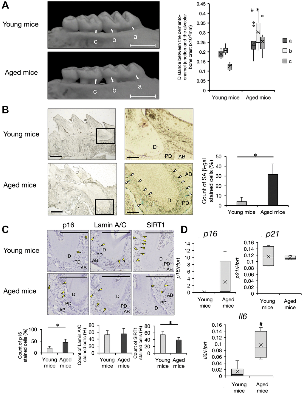 Analysis of periodontal tissue in aged mice. (A) Micro CT (μCT) analysis of alveolar bone in the upper jaw. Representative images of young (6-week-old) and aged (68~104 weeks-old) mice are shown. Scale bar = 1 mm. Quantification of the bone resorption rate in supportive alveolar bone was evaluated. Distance between the cement–enamel junction to the crest of alveolars bone at the a, mesial root at first molars, b, distal root at first molars, and c, mesial root at second molars. Box-and-whiskers plots shows median, 25th and 75th percentile with whiskers at the 5th and 95th percentile. Young mice; n = 7, aged mice; n = 11 Statistical analysis was completed using welch’s t-test, with p-values *p #p B) X-gal staining of frozen sections of periodontal tissue of the mesial root at first molars in the upper jaw. (×40) White arrows indicate SA-β-gal positive cells. Scale bar = 500 μm. Right panels show the enlarged image of the bold square in the left panel (×100). Scale bar = 100 μm. Abbreviations: D: Dentin; PD: Periodontal ligament; AB: Alveolar Bone. Representative data from three experiments are shown. Right graph shows the percentage of SA-β-gal positive cells in PDL of young or aged mice (*p C) Representative immunohistochemistry images of p16, lamin A/C, and SIRT1 (40×). Scale bar = 200 μm. Abbreviations: D: dentin; PD: periodontal ligament; AB: alveolar Bone. Yellow arrow: antibody-positive cells (40×). Representative data from three experiments are shown. Lower graph shows percentages of antibody-positive cells in PDL area of young or aged mice (*p D) Expression of p16, p21, and IL-6 in PDL tissue of young (6~13-weeks-old, n = 7) and aged (68~104-weeks-old, n = 6) mice. Expression of p16, p21, and IL-6 mRNA in PDL derived from freshly isolated mouse teeth was analyzed by qRT-PCR (#p 