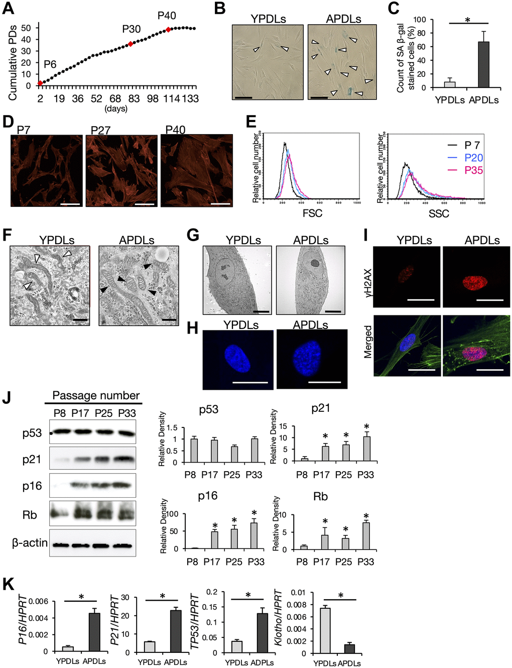 Establishment of senescent HPDL cells in vitro. (A) Long-term growth curve of primary human periodontal ligament (HPDL) cells. Cumulative population doublings (PDs) in each cell passage were estimated in long-term cultures. Final numbers of HPDL cells at the indicated passage are shown. P6, P30, and P40 represent early, premature, and late senescence of HPDL cells in vitro. Representative data from three experiments are shown. (B) SA β-gal staining of YPDLs and APDLs. Scale bar = 50 μm. White bar: YPDLs; black bar: APDLs (C) Quantification of SA β-gal-positive YPDLs and APDLs (*p D) Phalloidin staining of P7, P27, and P40 HPDL cells (×400). Scale bar = 200 μm. Representative data from three experiments are shown. (E) Quantification of the size of HPDL cells at P7, P20, and P35 HPDL cells. FSC and SSC of flow cytometric analysis are shown. Representative data from three experiments are shown. (F) Representative transmission electron microscopy images of mitochondria in YPDLs and APDLs. White arrows indicate lamellar shaped mitochondria. Black arrows indicate disorganized mitochondria (×31800). Scale bar = 500 nm (G) Transmission electron microscopy of induction of aggregated chromosomal DNA in YPDLs and APDLs. (×1760). Scale bar = 10 μm. (H) Analysis of SAHF in YPDLs and APDLs. DAPI staining of YPDLs and APDLs (×1000). Scale bar = 25 μm. (I) Confocal image of γH2AX staining in YPDLs and APDLs. Red: γH2AX; Green: Actin fiber; Blue: DAPI staining (×400). Scale bar = 25 μm. (J) Protein expression of cell cycle arrest-related factors p53, p21, p16, and Rb in P8, P17, P25, and P33 HPDL cells. β-actin was used as a loading control. Representative band images are shown, and the relative protein levels were quantified (*p K) Increased expression of senescence-related biomarkers in YPDLs and APDLs. Relative mRNA expression of p16, p21, p53, and klotho to HPRT in HPDL cells quantified by qRT-PCR. Gray bar: YPDLs; Black bar: APDLs. Data are presented as the mean ± SE (*p 