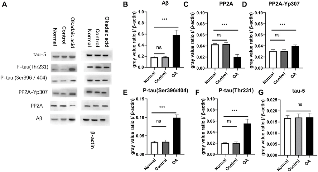 Aβ and P-tau expression in mice. Two weeks after stereotaxic injection, the expression of Aβ and P-tau in the hippocampus of the three groups of mice were detected by Western blot (A). The gray value analysis showed that there was no significant difference in the expression of Aβ between the normal group and the control group, and were significantly lower than the okadaic acid (OA) group (B) (ns: P = 0.985; ***P n = 6, LSD test). The expression of PP2A of OA group was obviously lower than that of the normal group and the control group (C), but there is no difference between the normal and control group (ns: P = 0.792; ***P D) (***P E) (***P F) (***P P values were 0.582, 0.936 and 0.600 respectively. The expression of tau-5 (G) was not significantly different among the 3 groups (ns, P = 0.724 and 0.799). Normal: Mice without stereotactic puncture; control: The mice were punctured stereotaxically and injected with 5 μL of normal saline; OA: Mice were subjected to stereotactic puncture and injection of 5 μL of 0.1 μM okadaic acid. (LSD test, n = 6).
