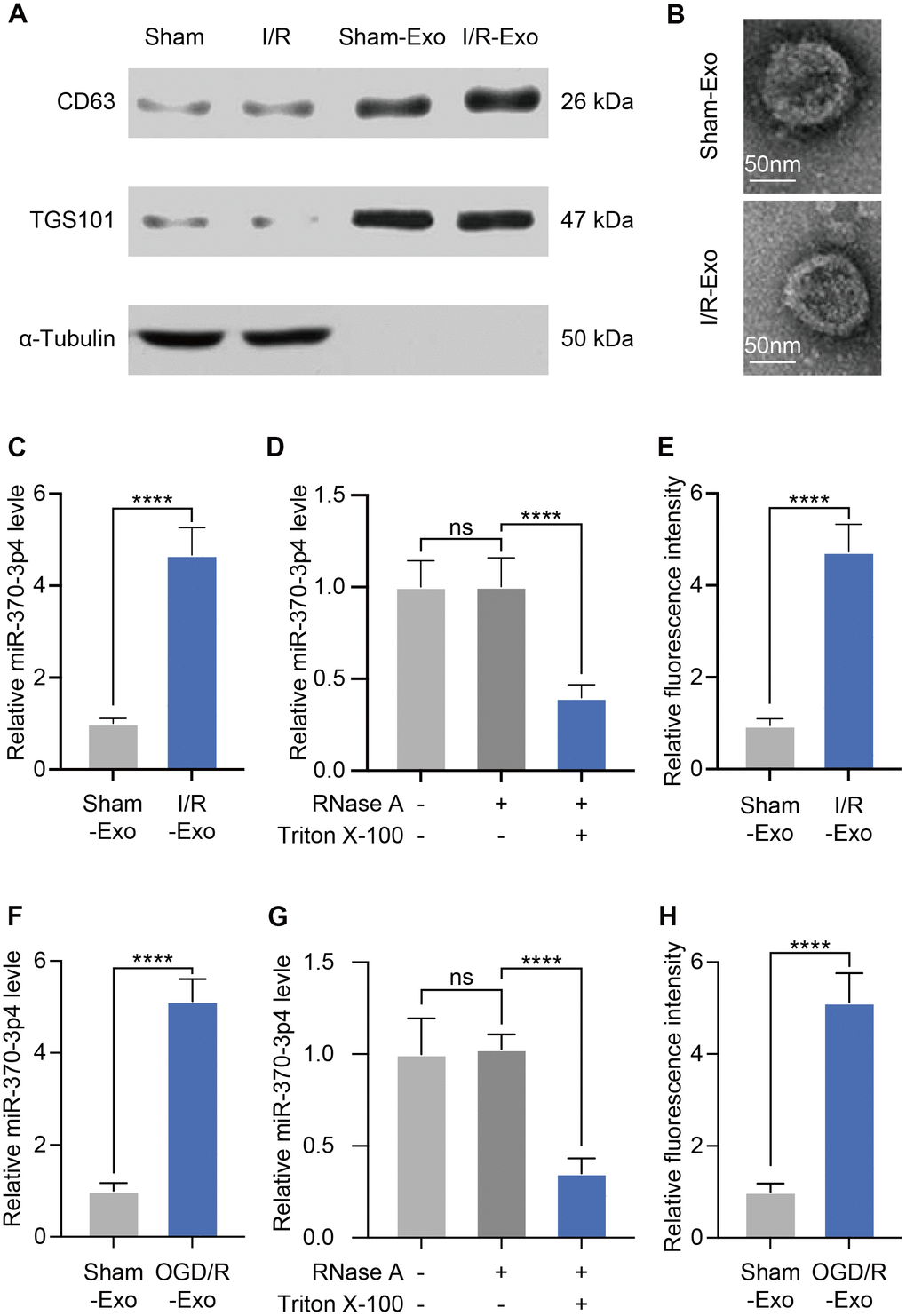 Exosomes derived from cerebral I/R rats exhibit miR-370-3p upregulation. (A) The levels of CD63, TSG101, and α-Tubulin were tested by western blotting. (B) Cerebral MVs-derived exosomes were analyzed via electron microscopy (scale bar, 50 nm). (C) Relative miR-370-3p expression in exosomes derived from MVs were tested by qPCR. (D) After treatment with 2 mg/ml RNase alone or combined with 0.1% Triton X-100, miR-370-3p level was analysed using qPCR in the culture medium of MVs. (E) miR-370-3p expression was assessed by fluorescence in situ hybridization (FISH) in cerebral I/R rats and healthy rats. (F) miR-370-3p expression levels in bEND.3, were assessed via qPCR. (G) After treatment with 2 mg/ml RNase alone or combined with .1% Triton X-100, miR-370-3p level was analysed using qPCR in the culture medium of bEND.3. (H) Quantitative analysis indicated that relative fluorescence intensity in bEND.3. ** p