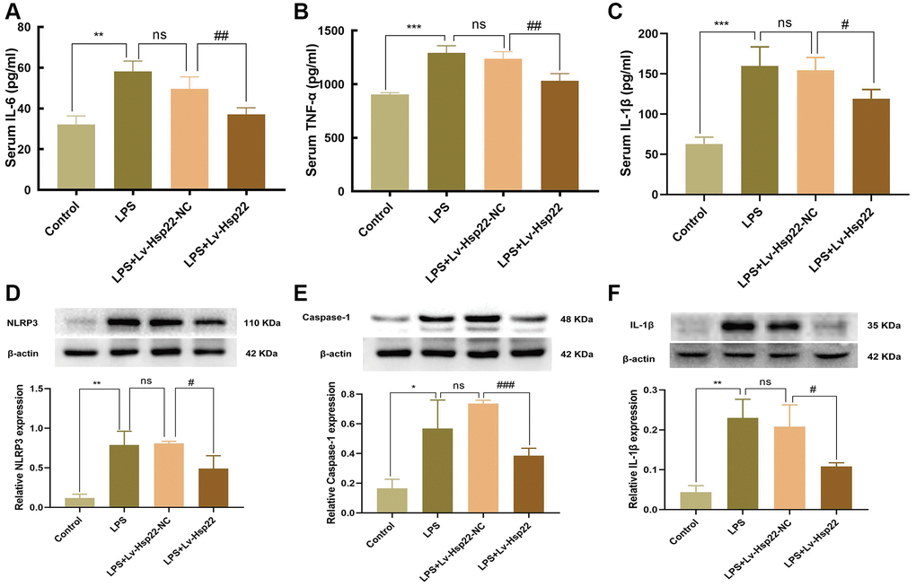 Effect of Hsp22 on LPS-induced activation of NLRP3/Caspase-1/IL-1β pathways in the mice hippocampus tissue. The serum levels of IL-6, TNF-α and IL-1β. (A–C) (**p ***p ***p p > 0.05, LPS vs. LPS+Lv-Hsp22-NC; ##p ##p #p D–F). (**p *p **p p > 0.05, LPS vs. LPS+Lv-Hsp22-NC; #p ###p #p 