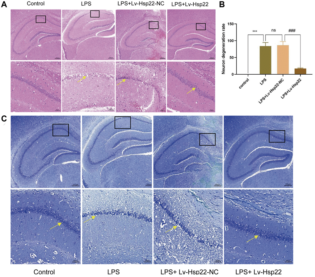 Hsp22 overexpression pretreatment improves hippocampus tissue damage induced by LPS. (A) Histological analysis of Hippocampus tissue via HE staining (×200). (B) The degeneration rate of neurons in LPS group was higher than that in control group, and the difference was statistically significant (***p ###p C) Histological analysis of Hippocampus tissue via Nissl Staining (×200).