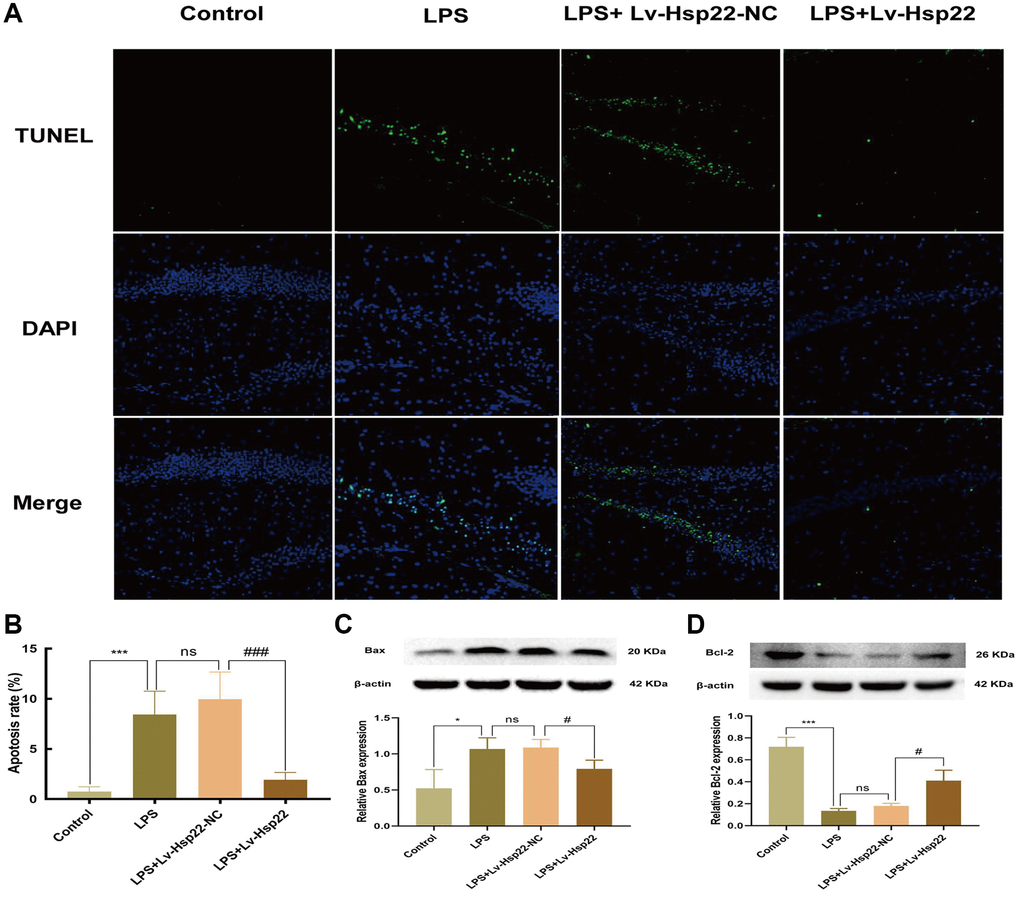 Hsp22 overexpression pretreatment alleviates hippocampus tissue apoptosis induced by LPS. (A, B) Representative images of Tunel-stained brain sections (×200) (***p p > 0.05, LPS vs. LPS+Lv-Hsp22-NC; ###p C) The protein band of Bax and its expression. (D) The protein band of Bcl2 and its expression. (*p ***p p > 0.05, LPS vs. LPS+Lv-Hsp22-NC; #p #p 