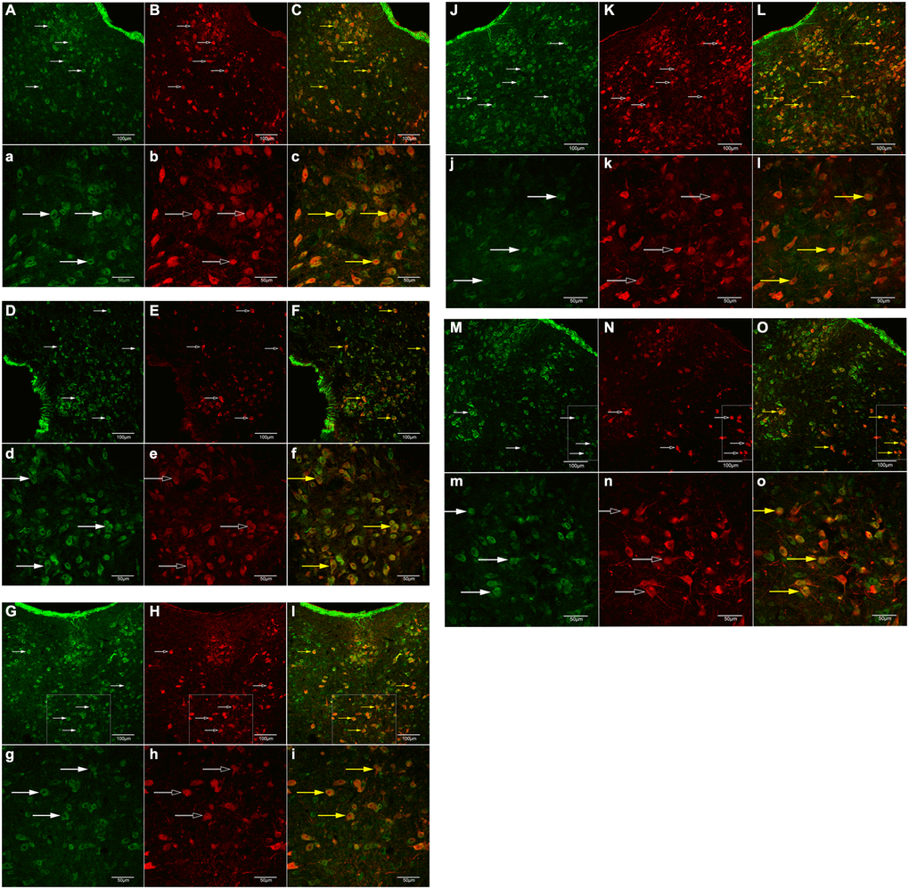 IF of GB1 and 5-HT neurons in the DRN. (A, a), (B, b), (C, c): control group; (D, d), (E, e), (F, f):AOM group; (G, g), (H, h), (I, i): BXD group; (J, j), (K, k), (L, l): AIM group; (M, m), (N, n), (O, o): SY group. (A, a), (D, d), (G, g), (J, j) and (M, m): green-labeled GB1; (B, b), (E, e), (H, h), (K, k) and (N, n): red-labeled 5-HT; (C, c), (F, f), (I, i), (L, l) and (O, o): double-labeled cells (yellow). (A–O): x200, scale = 50 mm; (a–o): x400, scale = 20 mm.