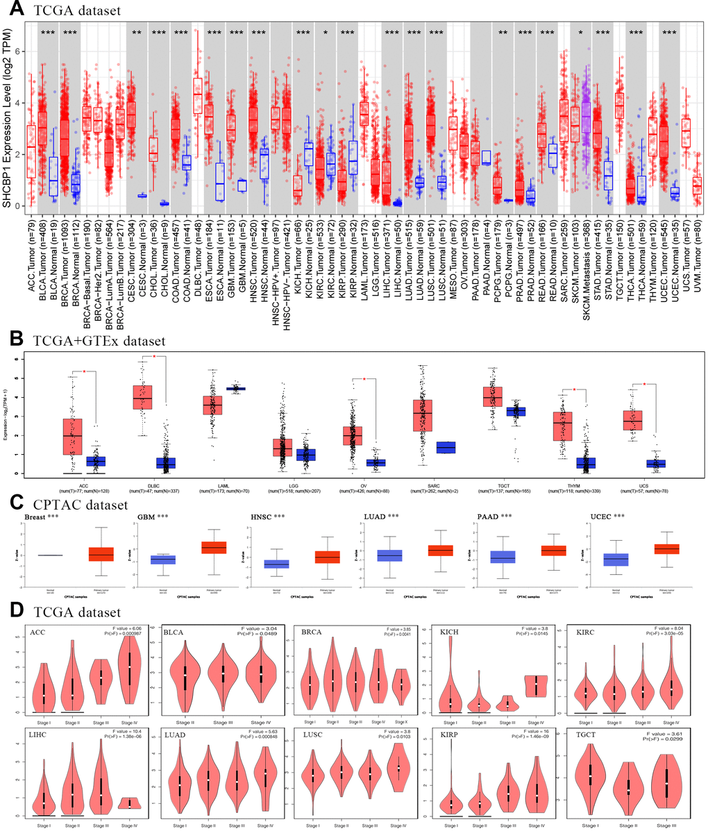Expression of SHCBP1 and its association with pathological stages. (A) The expression of SHCBP1 was analyzed by using TIMER2 in TCGA dataset. (B) SHCBP1 expression in ACC, DLBC, LAML, LGG, OV, SARC, TGCT, THYM and UCS based on TCGA and GTEx dataset. (C) The expression of SHCBP1 protein in breast cancer, GBM, HNSC, LUAD, PAAD and UCEC based on UALCLAN database. (D) The association between SHCBP1 expression and pathological stages in certain cancers of GEPIA database. *PPP
