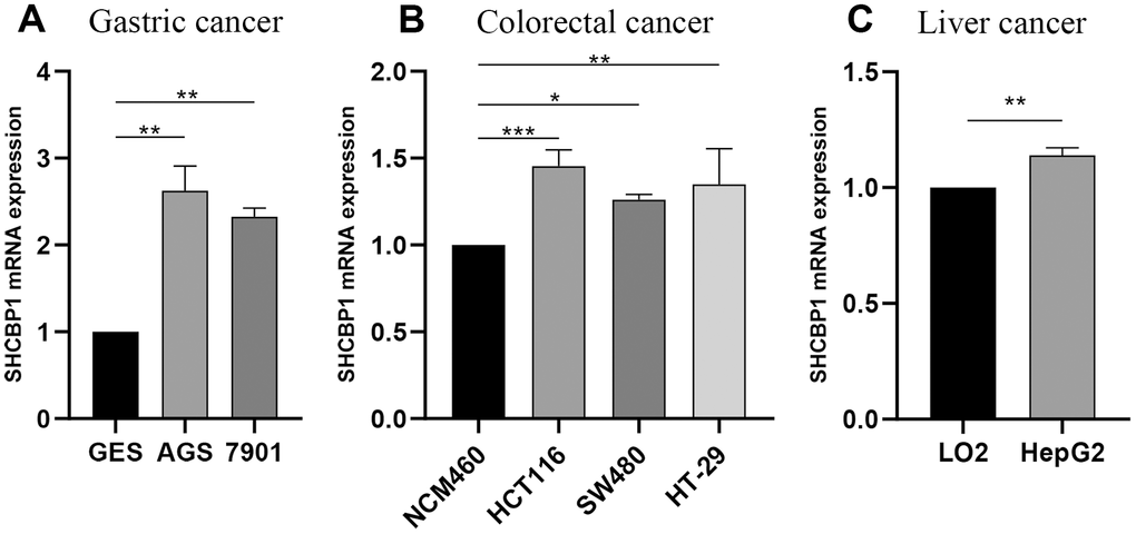Experimental verification of SHCBP1 mRNA expression by qRT-PCR analysis in various cancers. (A) Gastric cancer (B) Colorectal cancer (C) Liver cancer. *PPP
