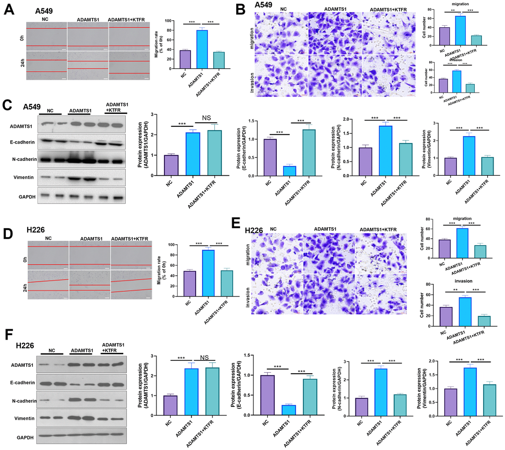 Effects of ADAMTS1 and KTFR on proliferation, cycle, migration, invasion, and EMT of the NSCLC A549 and H226 cell line. (A) The wound-healing assay showed the migration of A549 cells after treatment with KTFR. (B) Protein expressions of E-cadherin, N-cadherin, and Vimentin in A549 cells were detected using Western blot. (C) Transwell assay was used to detect migration and invasion of A549 cells (scale bar=50 μm). (D) The wound-healing assay showed the migration of H226 cells after adding KTFR. (E) Protein expressions of E-cadherin, N-cadherin, and vimentin in H226 cells were detected using Western blot. (F) Transwell assays were used to detect migration and invasion of H226 cells (scale bar=50 μm). NS P>0.05, **PP