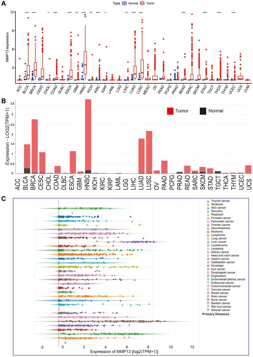 mRNA expression levels of MMP13 in pan-cancer. (A) The levels of MMP13 expression in different types of cancers were analyzed based on the TCGA database. The blue boxplots indicate the normal tissues. The red boxplots indicate the cancer tissues. *P **P ***P B) Analysis of MMP13 mRNA expression in different cancers by the GEPIA2 web tool. (C) MMP13 mRNA expression in 33 tumor cell lines from the CCLE database.