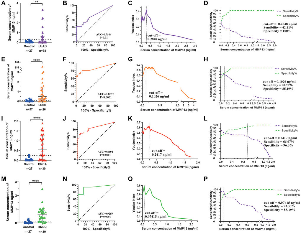 Evaluation of the diagnostic efficacy of serum MMP13. (A) Scatter plot analysis of serum concentrations of MMP13 in patients with LUAD and controls. (B) Serum MMP13 ROC curves for samples from patients with LUAD and control subjects. (C) Youden index and cut-off value in LUAD to serum MMP13 concentration. (D) Sensitivity and specificity in LUAD to serum MMP13 concentration. (E–H) Diagnostic tests for LUSC patients. (I–L) Diagnostic tests for BRCA patients. (M–P) Diagnostic tests for HNSC patients. The Mann-Whitney U-test was used for comparisons between the two groups. *P **P ***P ****P 