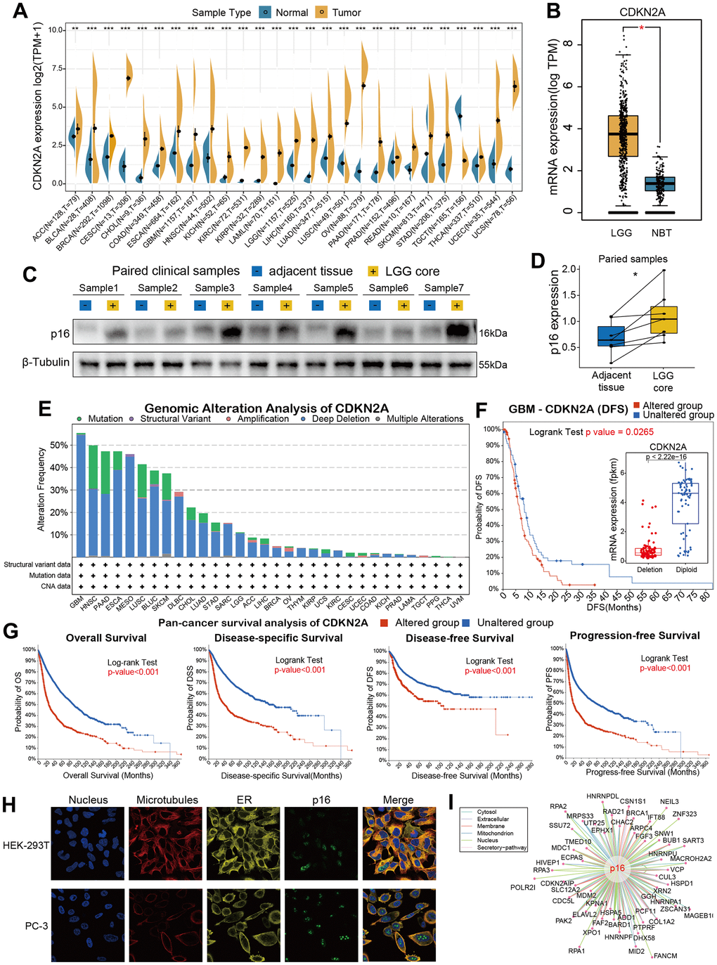 Basic information for CDKN2A. (A) The expression level of CDKN2A between tumor and normal tissue of each cancer based on the integration of data from the TCGA and GTEx datasets. (B)The CDKN2A expression in LGG and normal brain tissue. (C) The western blot assay showed the gray gels of proteins of LGG and adjacent tissues. (D) Quantitative analysis showed the upregulation of CDKN2A in LGG samples compared with adjacent tissues. (E) Analysis of the frequency of CDKN2A changes in pan-cancer studies based on the cBioPortal database. (F) CDKN2A expression levels and DFS prognosis in GBM patients with CDKN2A altered and unaltered. (G) Pan-cancer survival of CDKN2A. (H) Immunofluorescence images and fusion images of CDKN2A protein in nuclei, endoplasmic reticulum, and microtubules in A-431 and U251 cell lines. (I) The protein-protein interaction (PPI) network presents a protein interacting with CDKN2A. Asterisks indicate statistical p-values (ns p>0.05, *p