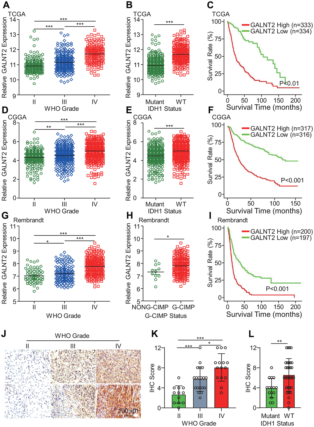 GALNT2 expression was highly expressed in GBM and IDH1 wildtype GBM. (A, D, G) GALNT2 expression was increased in WHO IV glioma in TCGA (A), CGGA (D), and Rembrandt (G) data sets. (B, E, H) GALNT2 expression was markedly elevated in IDH-wildtype gliomas in TCGA (B) and CGGA (E) and Rembrandt (H) data sets. (C, F, I) Increased GALNT2 expression predicts a poor prognosis of glioma patients assessed by Kaplan-Meier curves in TCGA (C) and CGGA (F), and Rembrandt (I) data sets. (J) GALNT2 protein expression was convincingly increased in WHO IV glioma. Representative images of IHC staining of GALNT2 protein in different grades of glioma specimens were shown. Scale bar: 100 μm. (K) Correlation between GALNT2 protein expression and WHO grades of gliomas. Clinical glioma specimens from 46 glioma patients were IHC-stained with anti-GALNT2 primary antibody. (L) GALNT2 expression was elevated in IDH1 wildtype group glioma patients. *, ** and *** indicate p 