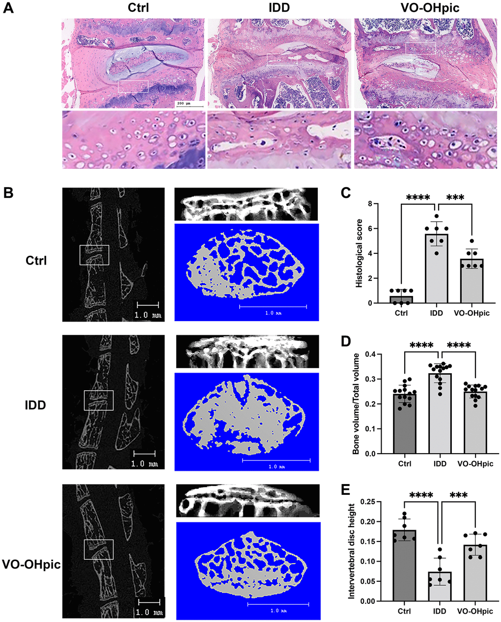 VO-OHpic significantly ameliorated IDD progression and cartilage endplate calcification in vivo. (A) HE staining of L4/5 intervertebral discs in Ctrl group, IDD group and IDD+VO-OHpic group. Scale bar = 200 μm. (B) Micro-CT analysis of L4/5 segments and cartilage endplate. Scale bar = 1 mm. (C) Histological score of the L4–5 segments of the lumbar spine among the three groups. (D) Quantification of cartilage endplate calcification via microarchitecture parameters (bone volume per tissue volume (BV/TV)). (E) Histomorphometric assessment of the intervertebral disc height. The disc height was calculated by the average of the anterior, middle and posterior of intervertebral disc. Data are presented as mean ± SD (n = 7/group). ***P ****P 