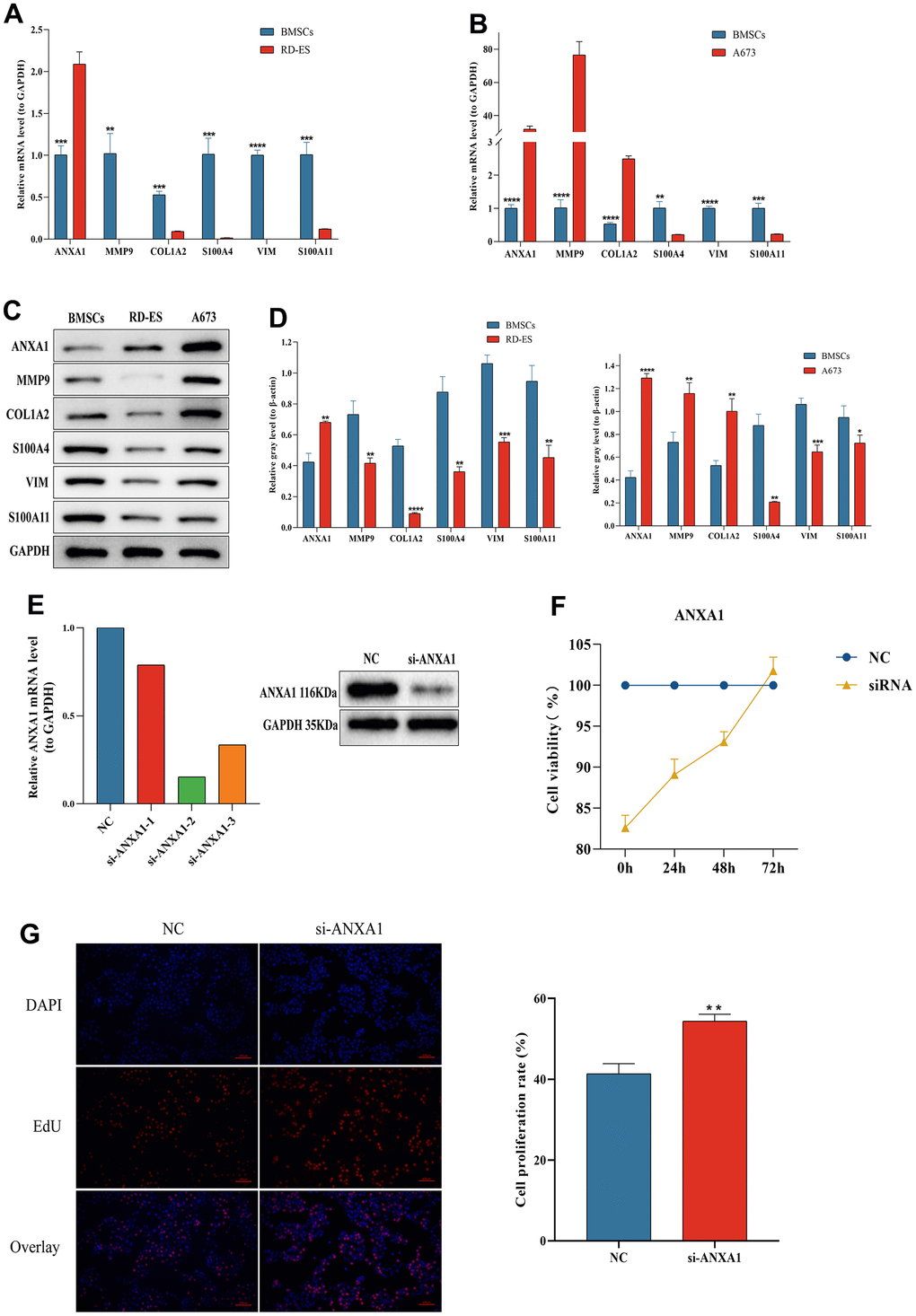 The expression levels of ANXA1-related module genes in ES cell lines and MSCs by RT-qPCR and Western blot and functional validation of ANXA1 in RD-ES cell using CCK-8 and EdU assays. The relative mRNA levels of ANXA1, MMP9, COL1A2, S100A4, VIM and S100A11 in RD-ES (A) or A673 (B) cells compared to MSCs. (C) The protein levels of ANXA1-related module genes in ES cell lines and MSCs by Western blot. (D) Quantitative analysis of protein expression levels of module genes. (E) The efficiency of si-ANXA1 was detected by RT-qPCR and Western blot analysis. (F) ES-RD cell viability at 24 h, 48 h and 72 h after downregulation of ANXA1 was measured using a CCK-8 assay. (G) The effect of ANXA1 on ES-RD cell proliferation was assessed by an EdU assay. P values are shown as follows: * PPPP