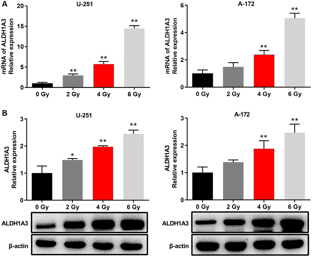 ALDH1A3 was essential for radioresistance in GBM cell lines. (A) The mRNA expression levels of ALDH1A3 when GBM cells were exposed to different doses of irradiation (0 Gy, 2 Gy, 4 Gy and 6 Gy). (B) The amount of ALDH1A3 protein in GBM cells after being exposed to various doses of irradiation (0 Gy, 2 Gy, 4 Gy and 6 Gy). β-actin served as control. *p **p 