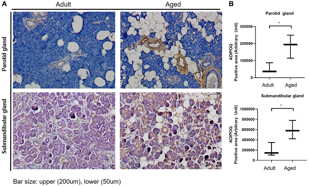 Immunohistochemical (IHC) staining of ADIPOQ in adult and aged human salivary gland tissues. (A) IHC staining of ADIPOQ in adult and aged parotid and submandibular gland tissues (B) Quantitative analysis of ADIPOQ expression in adult and aged parotid and submandibular gland tissues Results are presented as the mean ± SD and T-test was performed for statistical analysis *p 
