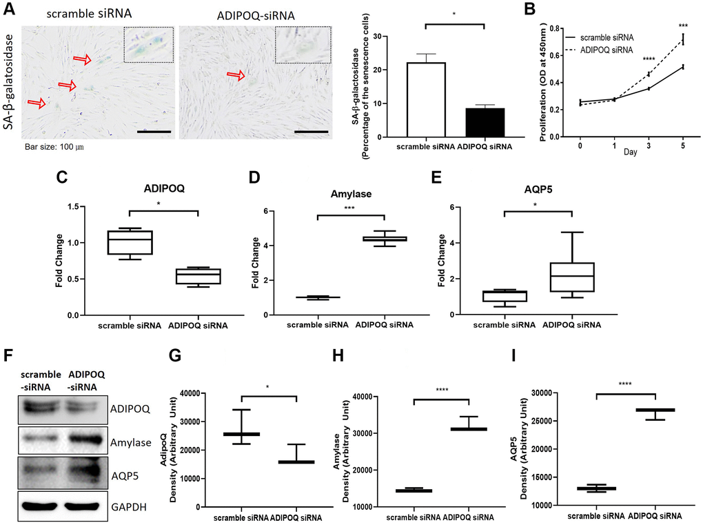 Silencing of ADIPOQ reduced cellular senescence and enhanced the proliferation and expression of salivary functional proteins. (A) β-Galactosidase assays of scrambled-siRNA and ADIPOQ-siRNA transfected primary cultured SG cells. (B) Proliferations of ADIPOQ-siRNA and scrambled siRNA treated SG cells. (C–E) The mRNA expressions of ADIPOQ, amylase, and AQP5 in ADIPOQ-siRNA and scramble-siRNA treated SG cells. (F–I) The protein levels of ADIPOQ, amylase and AQP5 in ADIPOQ-siRNA and scramble-siRNA treated SG cells. Results are presented as the mean ± SD and T-test was performed for statistical analysis, ****p ***p *p 