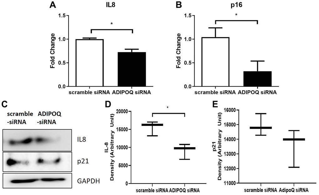 Effects of ADIPOQ gene knockdown on inflammatory factors. (A, B) Expressions of IL8 and p16 (proinflammatory genes) in ADIPOQ silenced cells. (C–E) Expressions of IL8 and p21 (a proinflammatory protein) in ADIPOQ silenced cells. Results are presented as the mean ± SD and T-test was performed for statistical analysis *p 