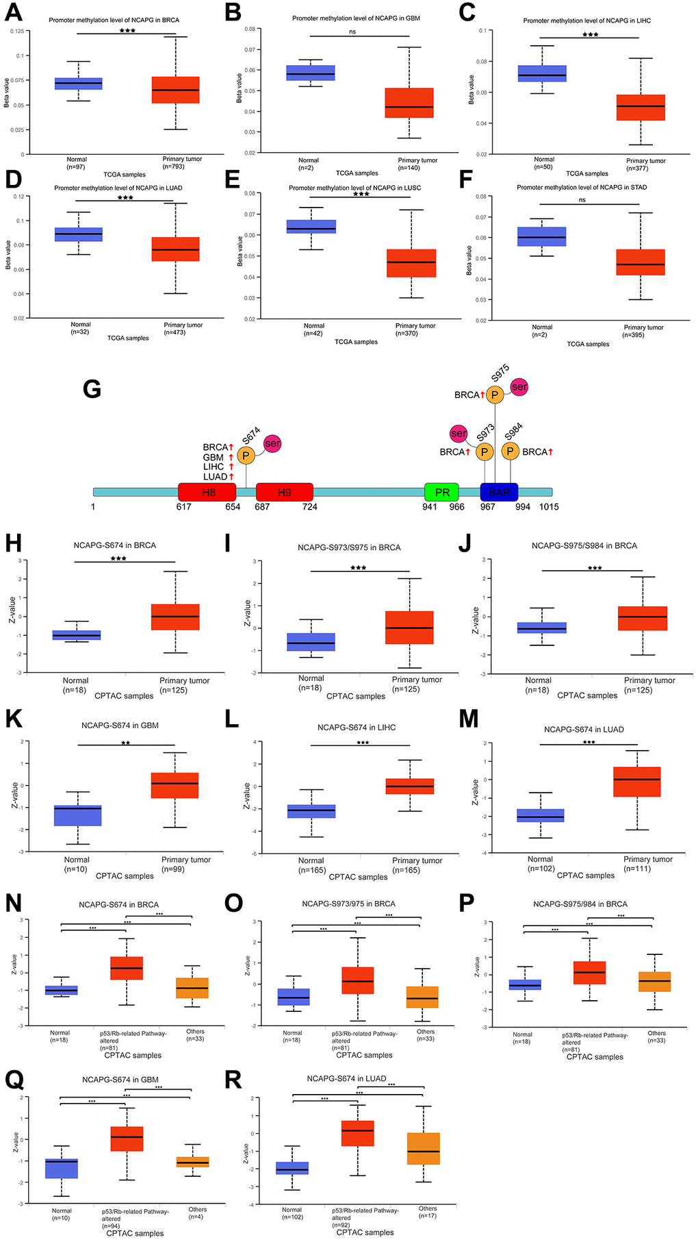 DNA methylation features of NCAPG in BRCA (A), GBM (B), LIHC (C), LUAD (D), LUSC (E) and STAD (F). Phosphorylation of NCAPG in several selected cancers according to the CPTAC database. (G) The schematic diagram and phosphorylation sites of the NCAPG protein are shown. The phosphorylation of NCAPG at S674, S973, S975 and 984 in BRCA (H–J), S674 in GBM (K), S674 in LIHC (L), S674 in LUAD (M). The P53 pathway phosphorylation of NCAPG at S674, S973, S975 and 984 in BRCA (N–P), S674 in GBM (Q), S674 in LUAD (R), from the UALCAN database. *p **p ***p 