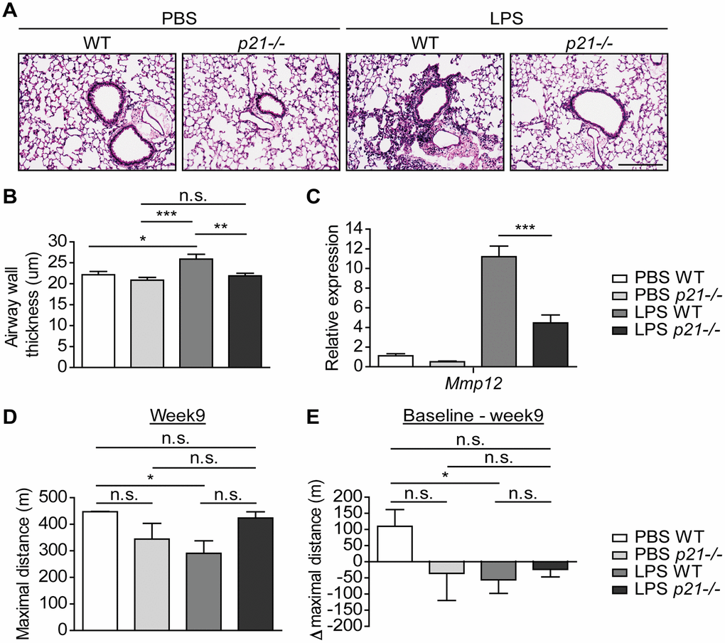 p21-/- improves the pathophysiology triggered by chronic LPS exposure. WT and p21-/- mice were exposed to either PBS or aerosolized LPS (0.5 mg/ml), 3 times a week for 10 weeks. At 48 hours following the last LPS exposure the lungs were harvested, fixed, and stained by H&E. (A) Representative images of lung sections featuring bronchi and alveoli of WT and p21-/- mice. Scale bar represents: 200μm. (B) Airway wall thickness of the lung described in (A). (C) mRNA expression levels of chronic bronchitis associated component Mmp12 in the lungs described in (A). (D) At week 9, mice fitness was assessed by a treadmill assay and was presented as maximal actual distance. (E) Delta maximal actual distance was calculated from the baseline point until week 9 of the mice described in (D). Data information: Data were analyzed using one-way ANOVA, *PB, C), and by Mann Whitney u test (D, E), *pA, B, n=5; C, n=3-8; D, E, n=4-5 independent repeats).